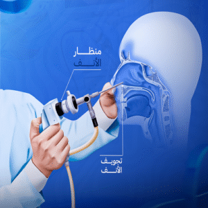 منظار الانف والجيوب الانفية